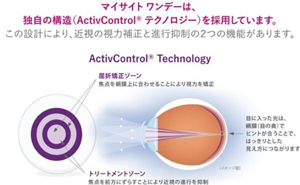 MiSight １dayは独自の構造（ActivControlテクノロジー）を採用しています